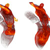 Patient-Specific Heart Flow Simulation